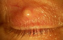 gradowka na gornej powiece